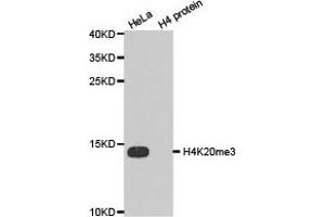 Western blot analysis of extracts of HeLa cell line and H4 protein expressed in E. (Histone 3 antibody  (3meLys20))