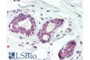 ABIN1590075 (5µg/ml) staining of paraffin embedded Human Breast. (HOXC10 antibody  (Internal Region))