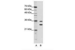 Image no. 1 for anti-Methenyltetrahydrofolate Synthetase Domain Containing (MTHFSD) (AA 60-109) antibody (ABIN202358)