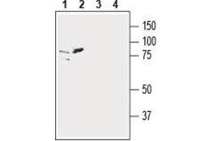 SLC39A6 antibody  (Extracellular, N-Term)
