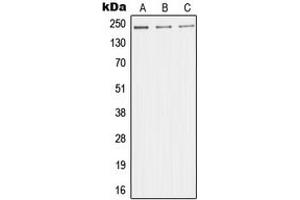 Western blot analysis of TRAP220 expression in HeLa (A), HuvEc (B), Jurkat (C) whole cell lysates. (MED1 antibody  (Center))