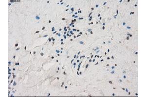 Immunohistochemical staining of paraffin-embedded Ovary tissue using anti-FCGR2A mouse monoclonal antibody. (FCGR2A antibody)