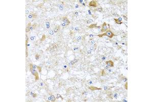 Immunohistochemistry of paraffin-embedded rat brain using ABCB8 antibody at dilution of 1:100 (x40 lens). (ABCB8 antibody)