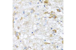 Immunohistochemistry of paraffin-embedded rat brain using ABCB8 antibody at dilution of 1:100 (x40 lens).