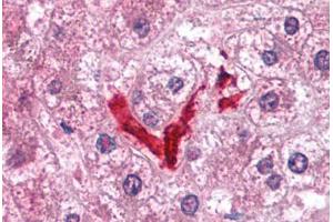 Human Liver, Kupffer Cells (formalin-fixed, paraffin-embedded) stained with DOK2 antibody ABIN214096 at 5 ug/ml followed by biotinylated goat anti-rabbit IgG secondary antibody ABIN481713, alkaline phosphatase-streptavidin and chromogen. (DOK2 antibody  (C-Term))