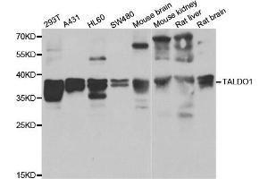 Western blot analysis of extracts of various cell lines, using TALDO1 antibody. (TALDO1 antibody)