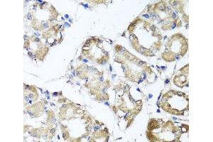 Immunohistochemistry of paraffin-embedded Human stomach using MGAT1 Polyclonal Antibody at dilution of 1:100 (40x lens).