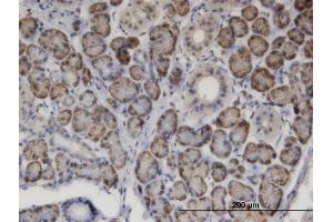 Immunoperoxidase of monoclonal antibody to MSRA on formalin-fixed paraffin-embedded human salivary gland.