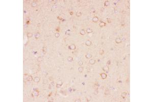 Anti-Tuberin Picoband antibody,  IHC(P): Mouse Brain Tissue (Tuberin antibody  (AA 1611-1807))