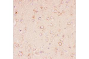 Anti-Tuberin Picoband antibody,  IHC(P): Mouse Brain Tissue (Tuberin antibody  (AA 1611-1807))