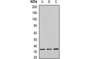 Western blot analysis of eIF2B1 expression in SHSY5Y (A), MCF7 (B), mouse liver (C), mouse brain (D) whole cell lysates. (EIF2B1 antibody)