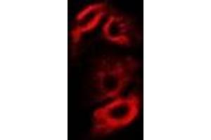 Immunofluorescent analysis of RPS10 staining in A549 cells. (RPS10 antibody)