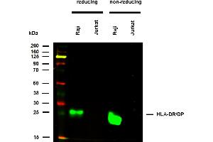 Anti-HLA-DR/DP (clone MEM-136) works in WB application under reducing and non-reducing conditions. (HLA-DP/DR antibody)