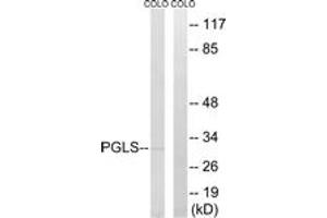 Western blot analysis of extracts from COLO cells, using PGLS Antibody. (PGLS antibody  (AA 191-240))