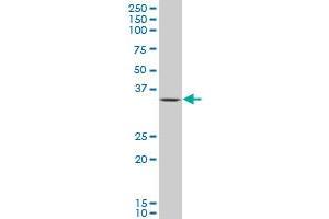 OTX1 polyclonal antibody (A01), Lot # MAI0060316QCS1 Western Blot analysis of OTX1 expression in Jurkat . (OTX1 antibody  (AA 10-116))