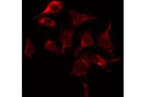 ABIN6269033 staining COS7 by IF/ICC. (TYR antibody)