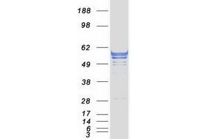 Western Blotting (WB) image for Carnosine Dipeptidase 1 (Metallopeptidase M20 Family) (CNDP1) protein (Myc-DYKDDDDK Tag) (ABIN2712905)