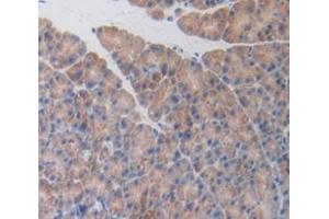 Figure. (Activin A Receptor Type IB/ALK-4 antibody  (AA 207-385))