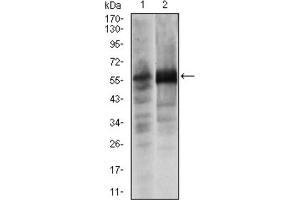 Western blot analysis using SOX9 antibody against Lovo (1) and SW620 (2) cell lysate. (SOX9 antibody)