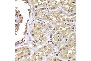 Immunohistochemistry of paraffin-embedded human kidney using RPS5 antibody at dilution of 1:100 (x400 lens). (RPS5 antibody)