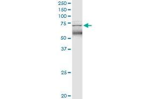 TRIM47 monoclonal antibody (M02), clone 3C8. (TRIM47 antibody  (AA 539-638))