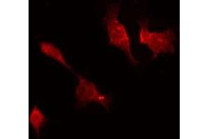 ABIN6277246 staining HepG2 by IF/ICC. (TNK2 antibody  (C-Term))