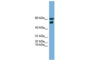 WB Suggested Anti-ZNF765 Antibody Titration: 0. (ZNF765 antibody  (N-Term))