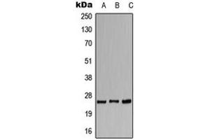 Western blot analysis of CACNG1 expression in HeLa (A), SP2/0 (B), H9C2 (C) whole cell lysates. (CACNG1 antibody  (Center))