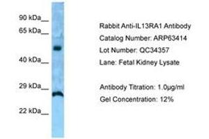 Image no. 1 for anti-Interleukin 13 Receptor, alpha 1 (IL13RA1) (AA 40-89) antibody (ABIN6749982) (IL13 Receptor alpha 1 antibody  (AA 40-89))