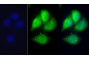 Detection of APOC1 in Human Hela cell using Polyclonal Antibody to Apolipoprotein C1 (APOC1) (APOC1 antibody  (AA 31-83))