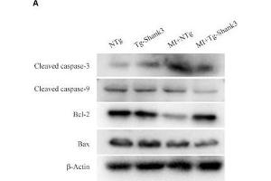 Shank3 overexpression inhibits cardiomyocytes apoptosis. (Caspase 9 antibody  (AA 1-98))