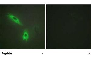 Immunofluorescence analysis of HeLa cells, using LTB polyclonal antibody . (LTB antibody  (C-Term))