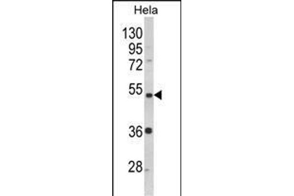 PPP2R2B antibody  (AA 104-130)