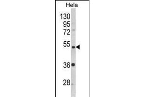 PPP2R2B antibody  (AA 104-130)