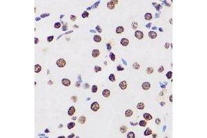 Immunohistochemical analysis of MacroH2A1 staining in human kidney formalin fixed paraffin embedded tissue section. (H2AFY antibody)