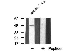 Western blot analysis of TNF Receptor II expression in Mouse lung lysate (TNFRSF1B antibody  (C-Term))