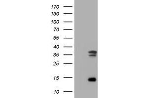 Image no. 2 for anti-Thymidylate Synthetase (TYMS) antibody (ABIN1501593)