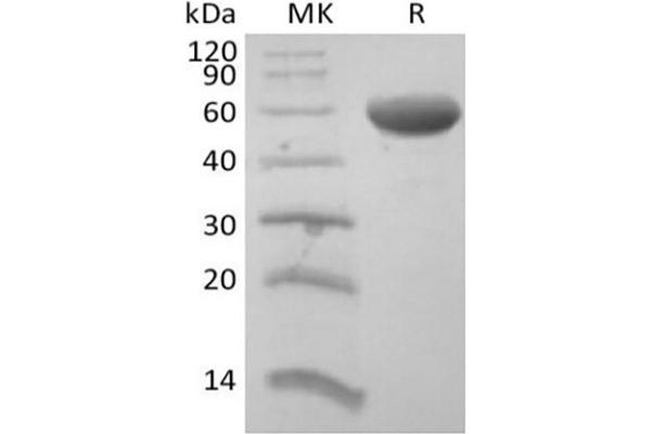 CD8B Protein (Fc Tag)