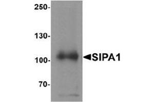 Western blot analysis of SIPA1 in human brain tissue lysate with SIPA1 antibody at 1 μg/mL. (SIPA1 antibody  (N-Term))
