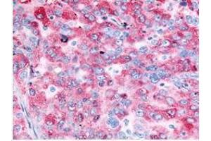 Immunohistochemistry (IHC) image for anti-Epidermal Growth Factor Receptor (EGFR) (C-Term) antibody (ABIN285758) (EGFR antibody  (C-Term))