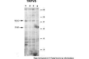 Sample Type: 1-4. (TRPV5 antibody  (N-Term))
