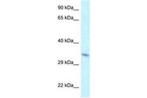 Image no. 1 for anti-TAF8 RNA Polymerase II, TATA Box Binding Protein (TBP)-Associated Factor, 43kDa (TAF8) (AA 109-158) antibody (ABIN6747733)