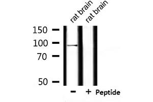 Western blot analysis of extracts from rat brain, using USP16 Antibody. (USP16 antibody  (N-Term))