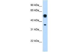 WB Suggested Anti-ASL Antibody Titration:  0. (ASL antibody  (N-Term))