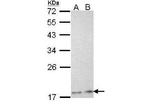 WB Image Sample (30 ug of whole cell lysate) A: H1299 B: Hela 12% SDS PAGE antibody diluted at 1:1000