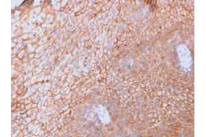 Immunohistochemistry (IHC) image for anti-CD40 Ligand (CD40LG) (AA 108-261) antibody (ABIN6941188)