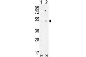 Western Blotting (WB) image for anti-Paraoxonase 1 (PON1) antibody (ABIN2995778)