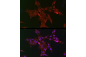 Immunohistochemistry of paraffin-embedded mouse stomach using DC Rabbit pAb (ABIN6132184, ABIN6139432, ABIN6139434 and ABIN6222532) at dilution of 1:150 (40x lens). (DCAF7 antibody  (AA 1-342))