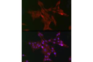 Immunohistochemistry of paraffin-embedded mouse stomach using DC Rabbit pAb (ABIN6132184, ABIN6139432, ABIN6139434 and ABIN6222532) at dilution of 1:150 (40x lens). (DCAF7 antibody  (AA 1-342))