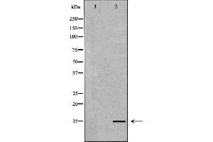Western blot analysis of extracts of human plasma , using NPPB antibody. (NPPB antibody  (Internal Region))